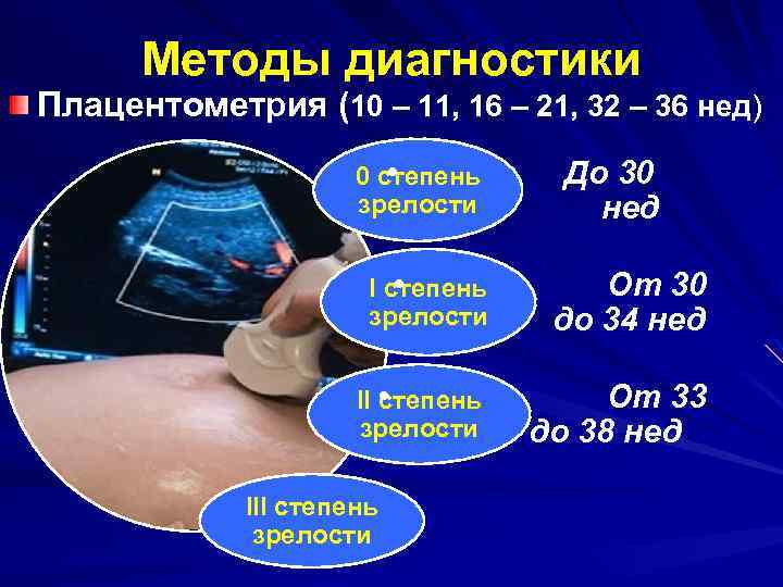 Методы диагностики Плацентометрия (10 – 11, 16 – 21, 32 – 36 нед) •