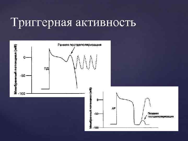 Триггерная активность 