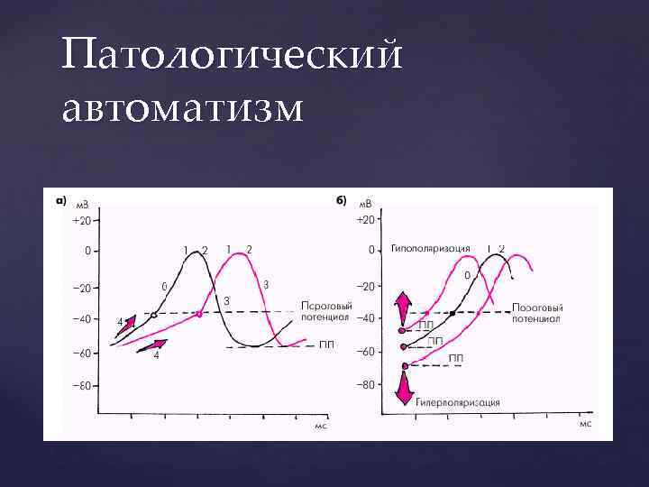 Патологический автоматизм 