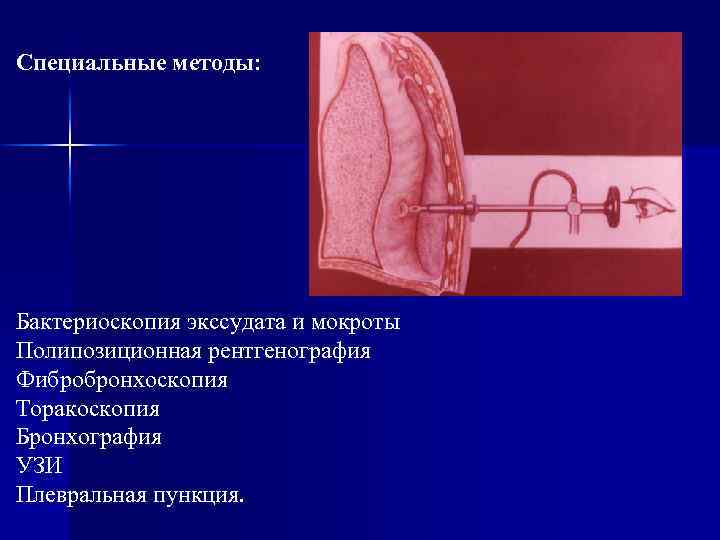 Специальные методы: Бактериоскопия экссудата и мокроты Полипозиционная рентгенография Фибробронхоскопия Торакоскопия Бронхография УЗИ Плевральная пункция.