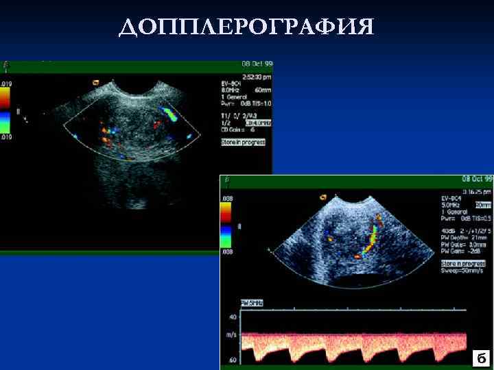 ДОППЛЕРОГРАФИЯ 