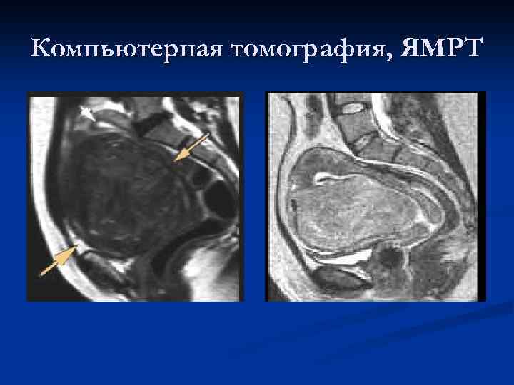 Компьютерная томография, ЯМРТ 