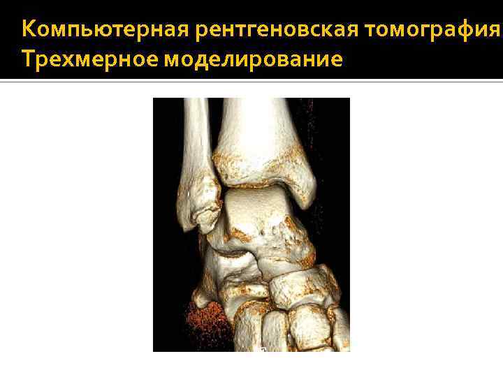 Компьютерная рентгеновская томография. Трехмерное моделирование 