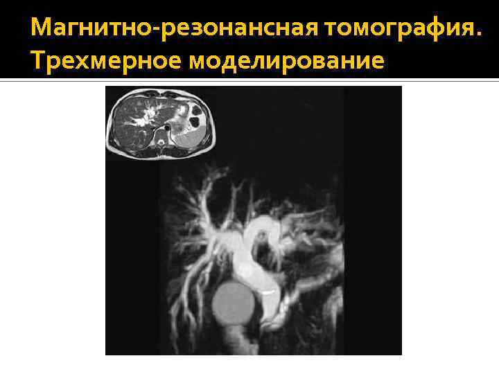 Магнитно-резонансная томография. Трехмерное моделирование 