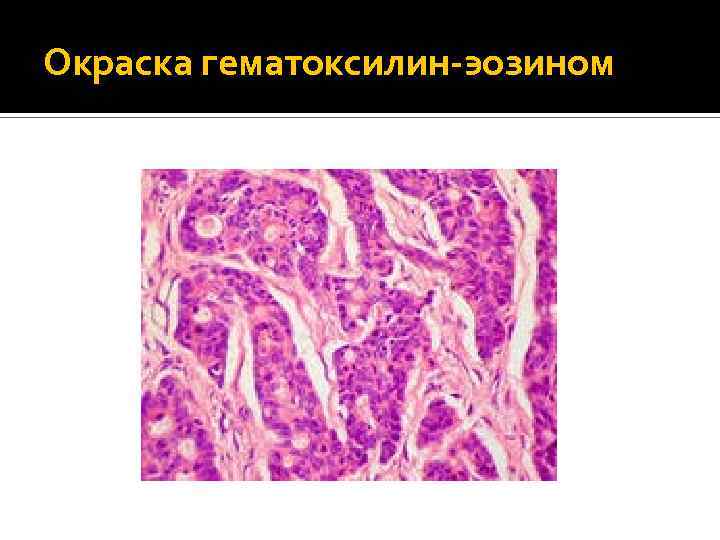 Окраска гематоксилин-эозином 