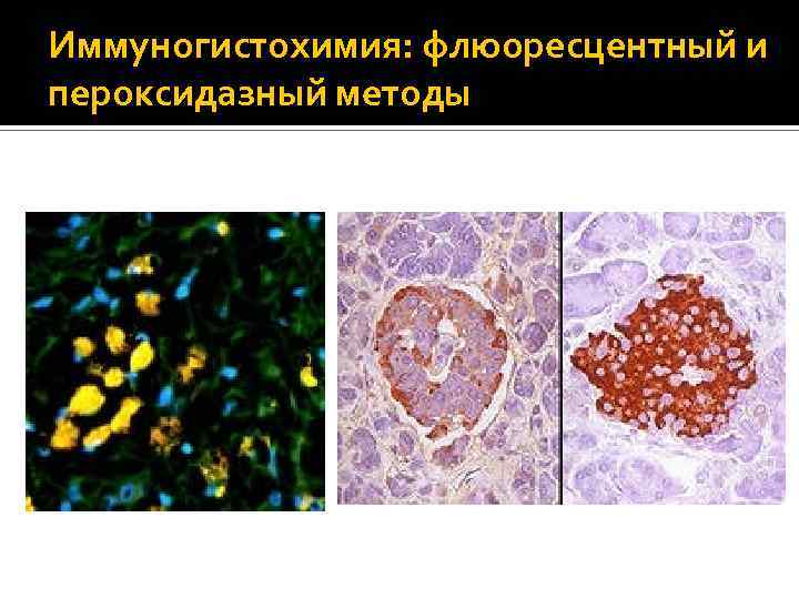 Иммуногистохимия: флюоресцентный и пероксидазный методы 