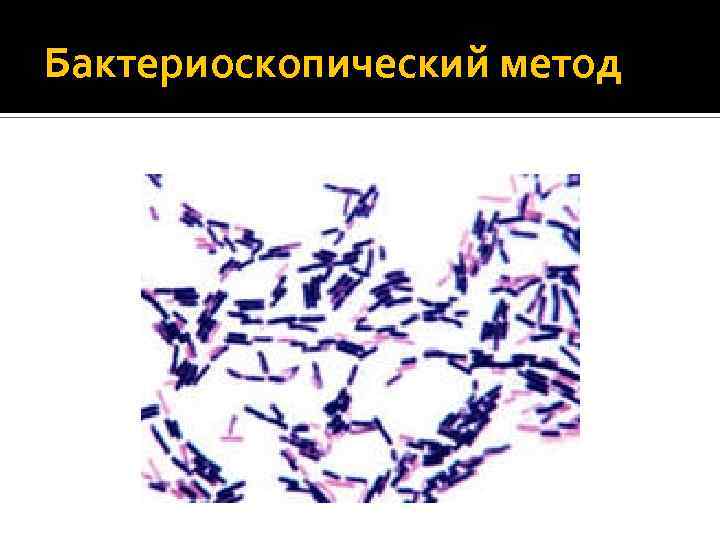 Бактериоскопический метод 