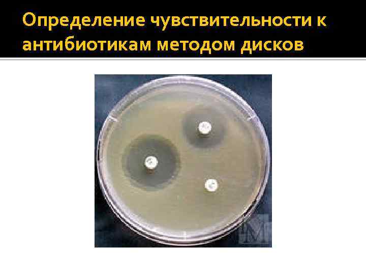 Определение чувствительности