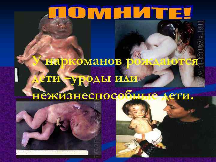 У наркоманов рождаются дети –уроды или нежизнеспособные дети. 