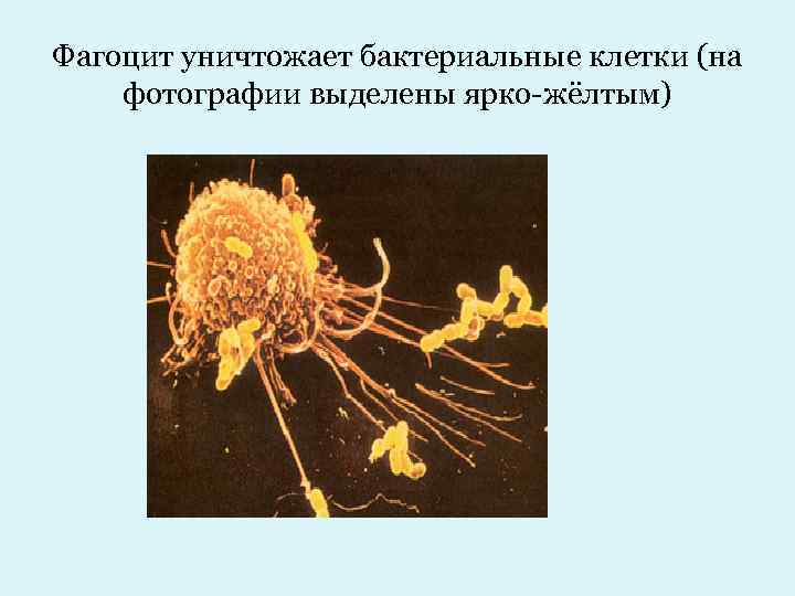 Фагоцит уничтожает бактериальные клетки (на фотографии выделены ярко-жёлтым) 