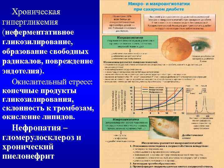Хроническая гипергликемия (неферментативное гликозилирование, образование свободных радикалов, повреждение эндотелия). Окислительный стресс: конечные продукты гликозилирования,