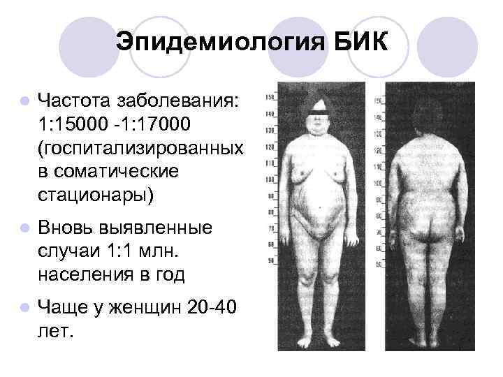 Эпидемиология БИК l Частота заболевания: 1: 15000 -1: 17000 (госпитализированных в соматические стационары) l