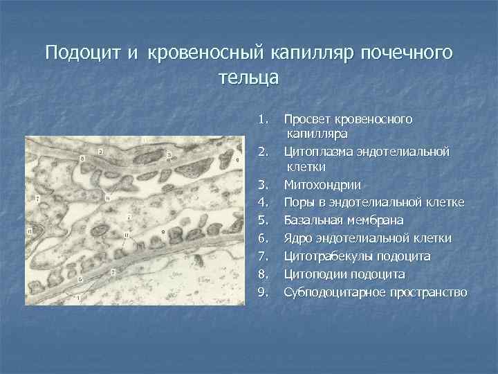 Подоцит и кровеносный капилляр почечного тельца 1. 2. 3. 4. 5. 6. 7. 8.
