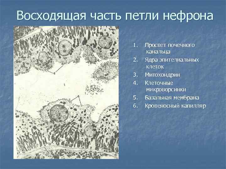 Восходящая часть петли нефрона 1. 2. 3. 4. 5. 6. Просвет почечного канальца Ядра