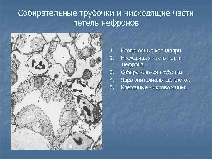 Собирательные трубочки и нисходящие части петель нефронов 1. 2. 3. 4. 5. Кровеносные капилляры