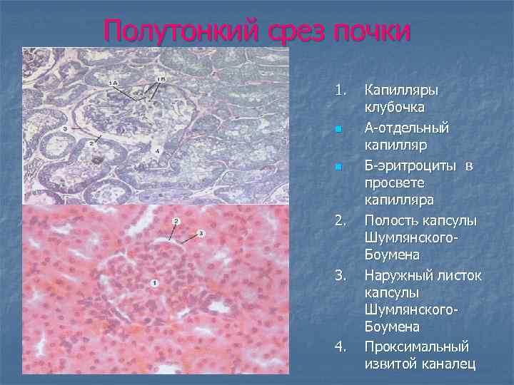 Полутонкий срез почки 1. n n 2. 3. 4. Капилляры клубочка А-отдельный капилляр Б-эритроциты
