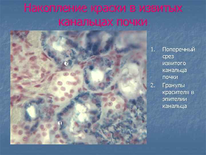 Накопление краски в извитых канальцах почки 1. 2. Поперечный срез извитого канальца почки Гранулы