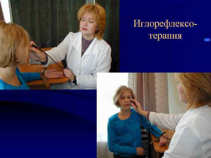 Иглорефлексотерапия 