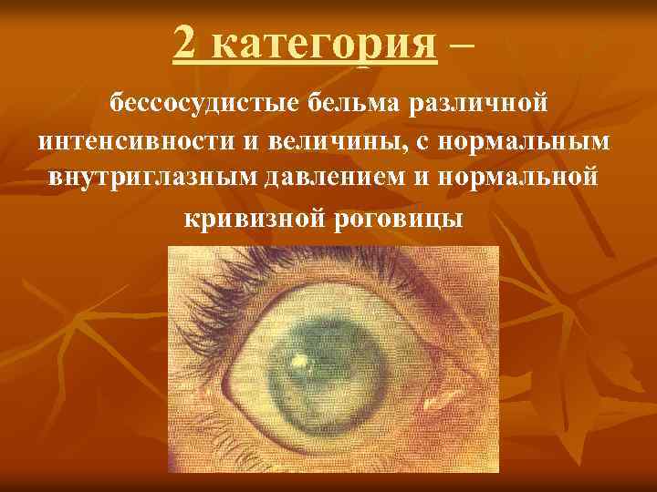 2 категория – бессосудистые бельма различной интенсивности и величины, с нормальным внутриглазным давлением и