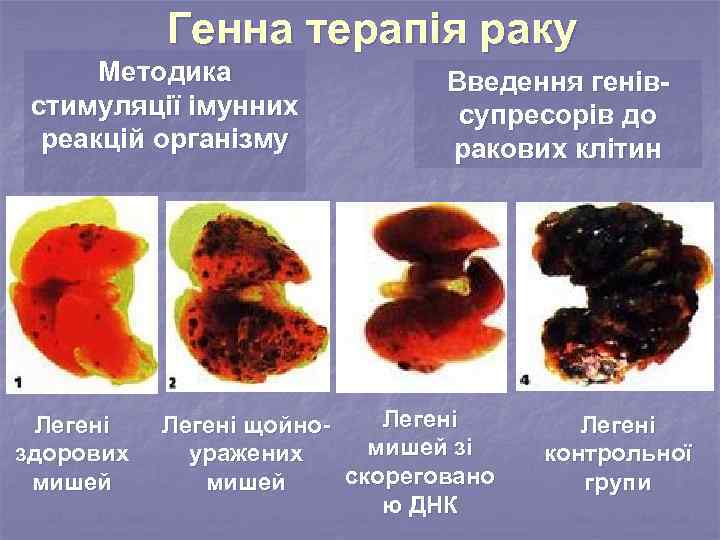 Генна терапія раку Методика стимуляції імунних реакцій організму Легені здорових мишей Введення генівсупресорів до