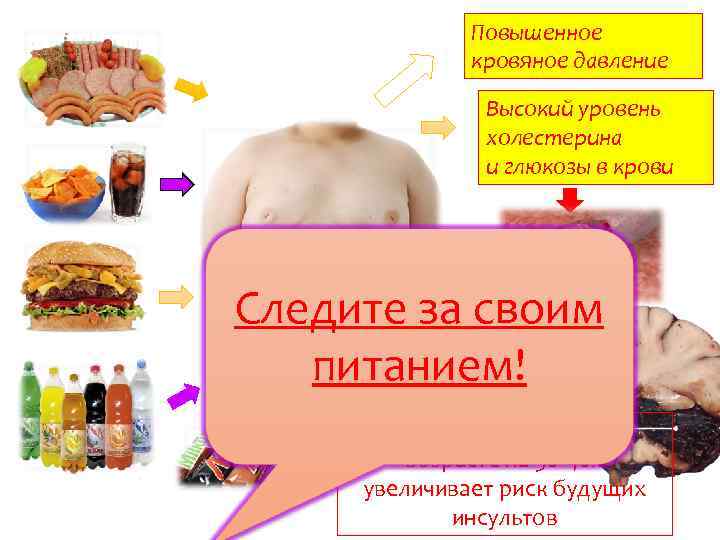 Неправильное питание Повышенное кровяное давление 2. Переедание Высокий уровень холестерина 3. Еда и глюкозы