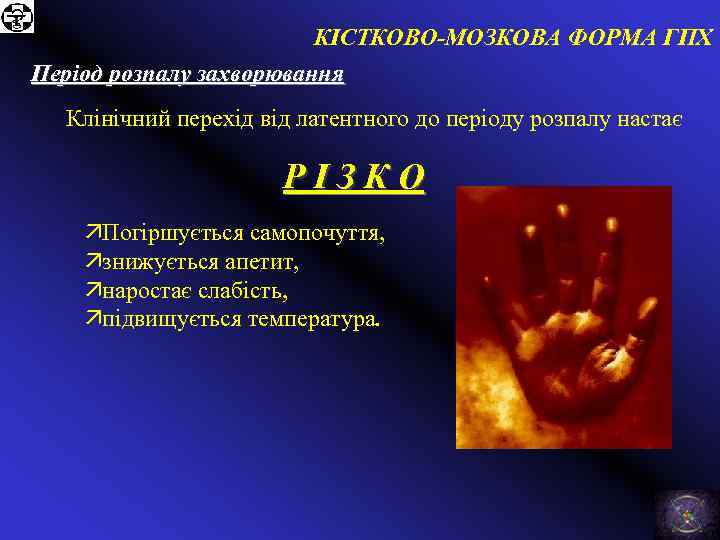 КІСТКОВО-МОЗКОВА ФОРМА ГПХ Період розпалу захворювання Клінічний перехід від латентного до періоду розпалу настає