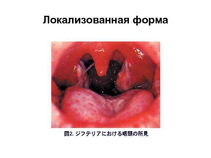 Локализованная форма 