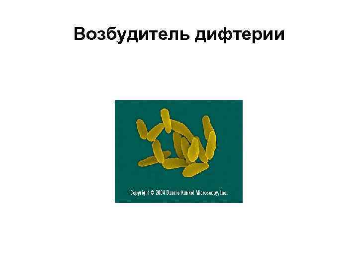 Возбудитель дифтерии 