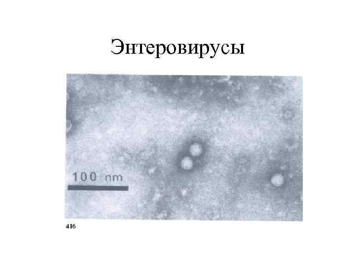 Энтеровирусы 