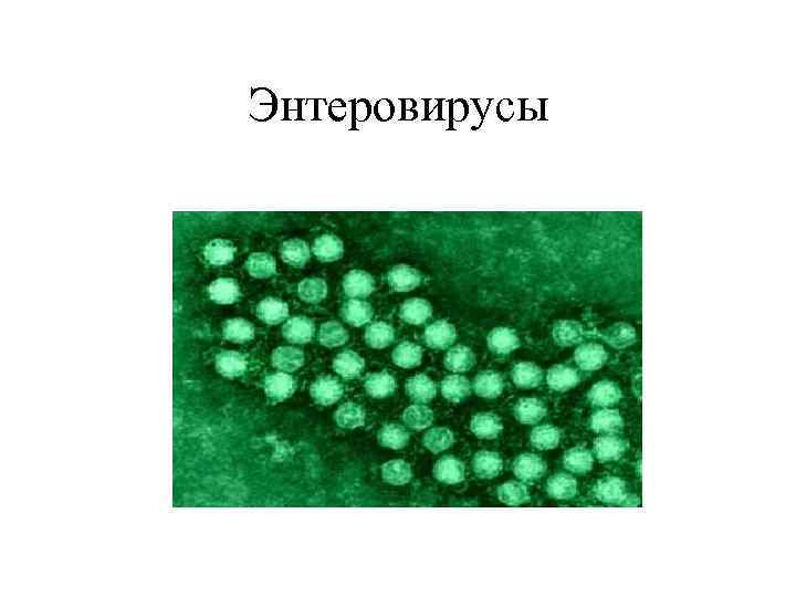 Энтеровирусы 