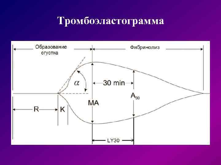 Тромбоэластограмма 