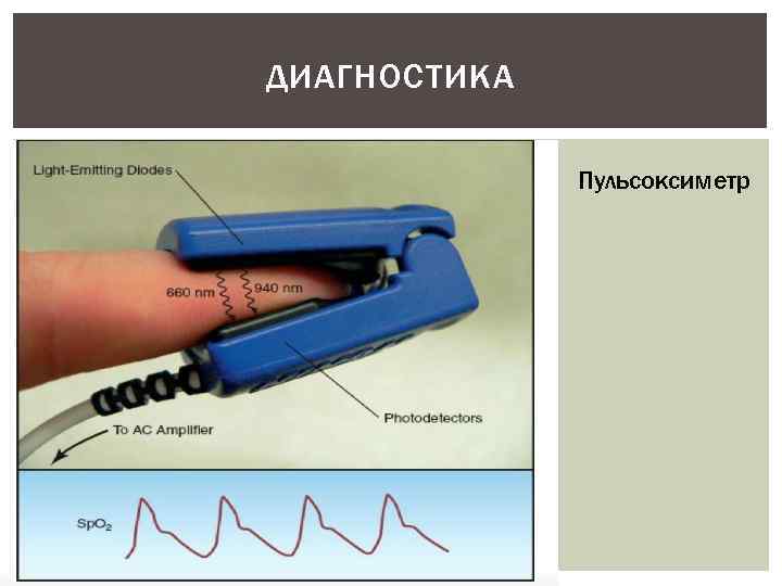 ДИАГНОСТИКА Пульсоксиметр 