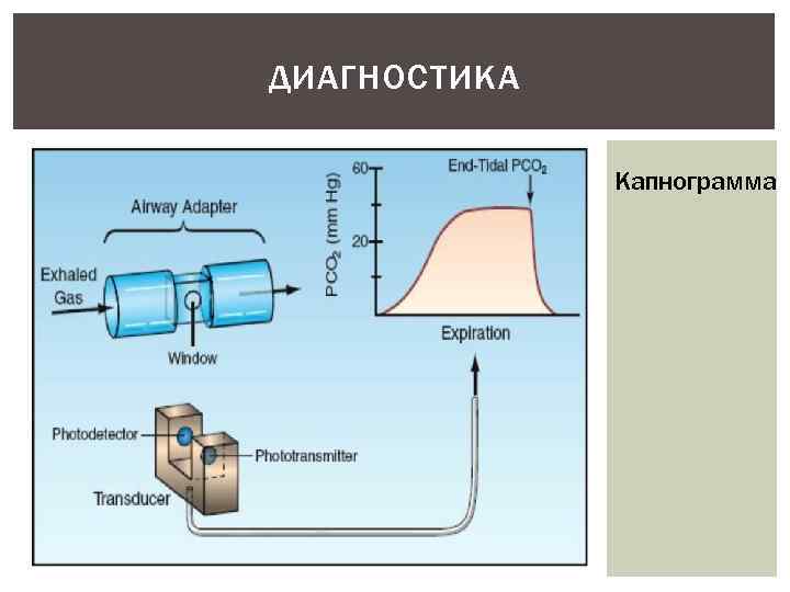 ДИАГНОСТИКА Капнограмма 