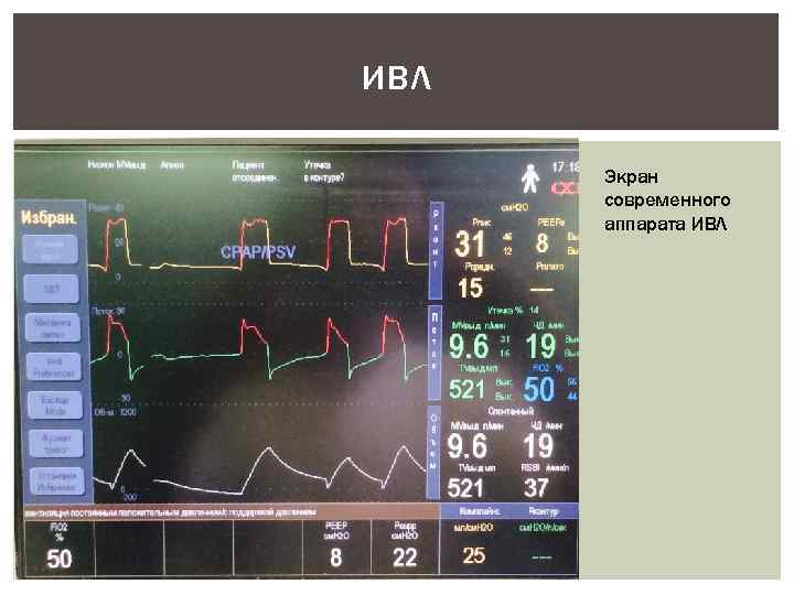 ИВЛ Экран современного аппарата ИВЛ 