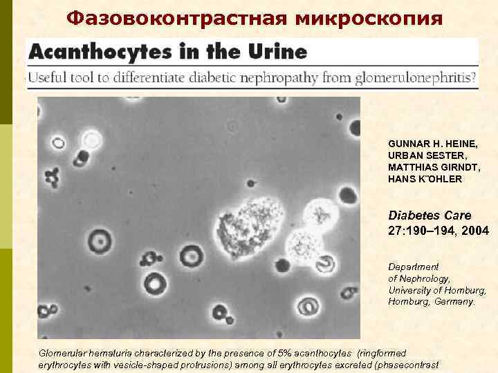  Фазовоконтрастная микроскопия GUNNAR H. HEINE, URBAN SESTER, MATTHIAS GIRNDT, HANS K¨OHLER Diabetes Care