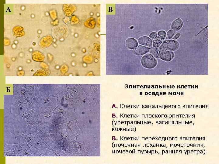 Осадки мочи под микроскопом в картинках