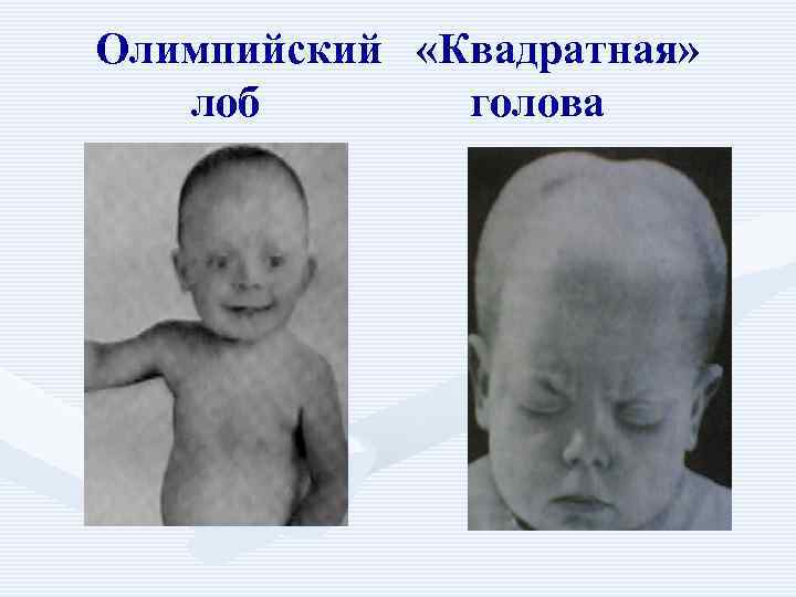 Олимпийский «Квадратная» лоб голова 