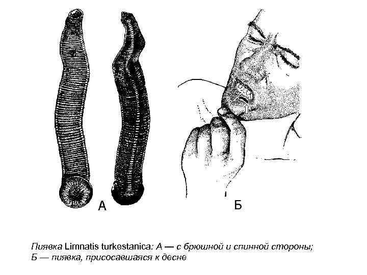 Пиявка Limnatis turkestanica: А — с брюшной и спинной стороны; Б — пиявка, присосавшаяся