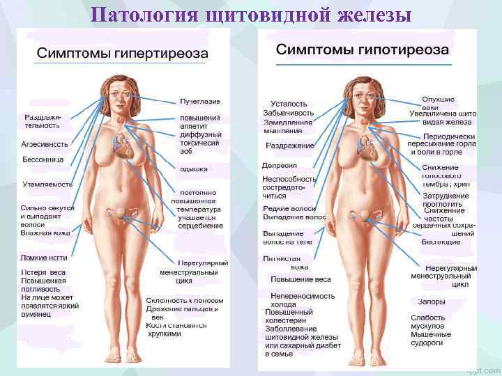 Патология щитовидной железы 