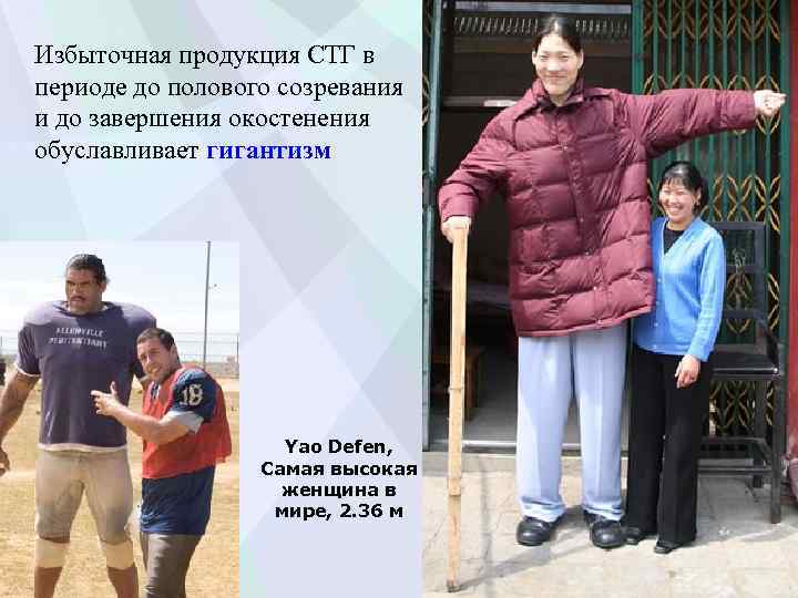 Избыточная продукция СТГ в периоде до полового созревания и до завершения окостенения обуславливает гигантизм