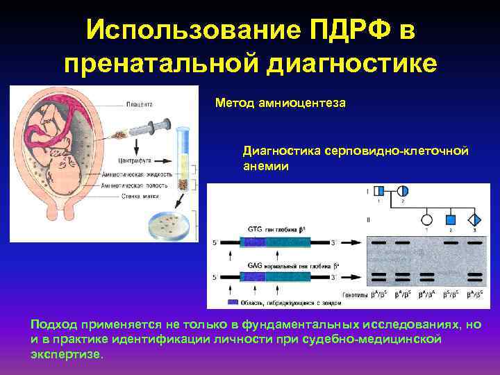 Пренатальная диагностика картинки