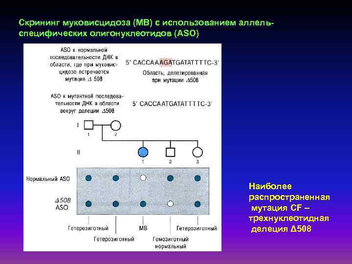 Скрининг муковисцидоза (МВ) с использованием аллельспецифических олигонуклеотидов (ASO) Наиболее распространенная мутация CF – трехнуклеотидная