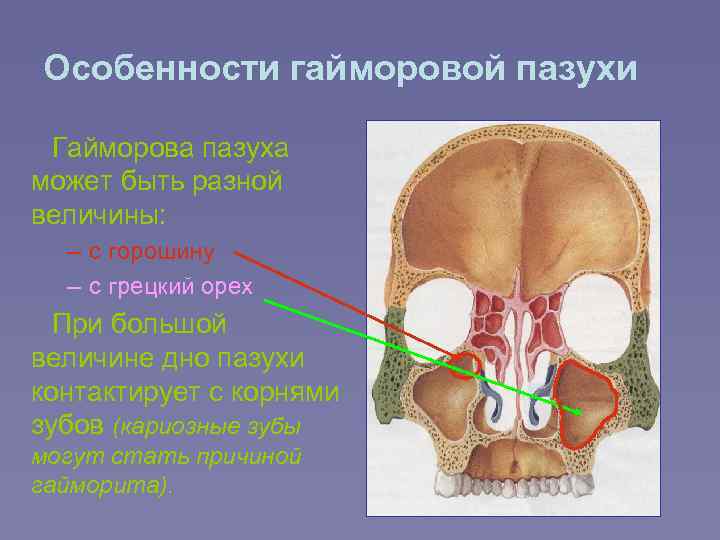 Правая пазуха. Кости гайморовой пазухи. Сообщение верхнечелюстной пазухи с полостью носа. Гайморова пазуха и полость носа.