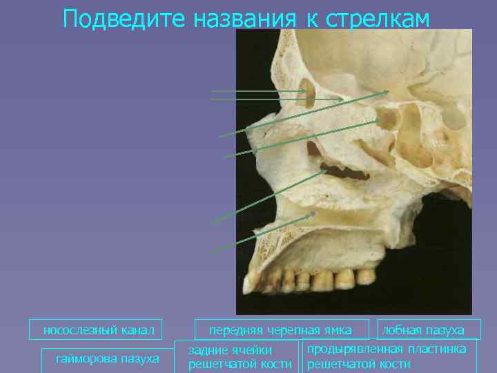 Подведите названия к стрелкам носослезный канал гайморова пазуха передняя черепная ямка лобная пазуха продырявленная