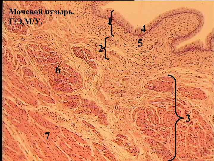 Мочевой пузырь. Г/Э, М/У. 1 2 4 5 6 3 7 
