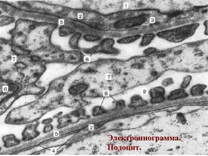 Электроннограмма. Подоцит. 