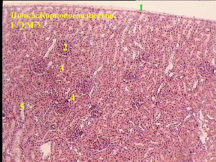 Почка. . Корковое вещество. Г/Э, М/У. 2 3 5 4 1 
