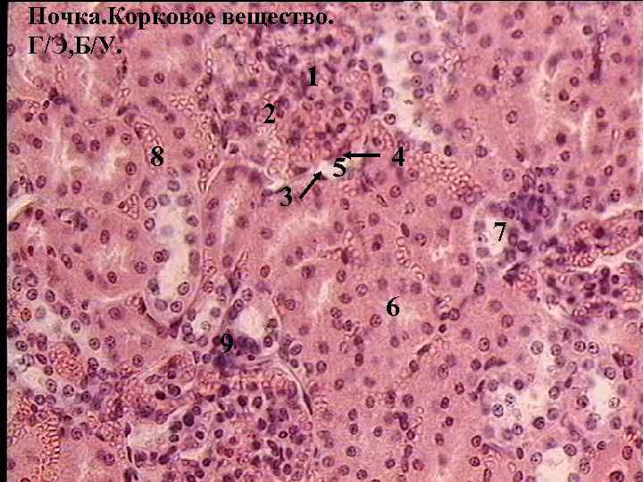 Почка. Корковое вещество. Г/Э, Б/У. 1 2 8 3 5 4 7 6 9