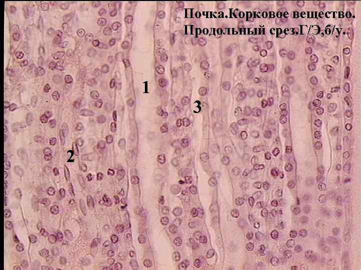 Почка. Корковое вещество. Продольный срез. Г/Э, б/у. 1 2 3 