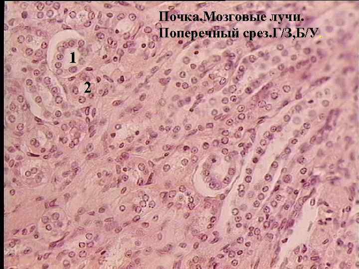 Почка. Мозговые лучи. Поперечный срез. Г/З, Б/У. 1 2 